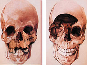 Atapuerca kafatası