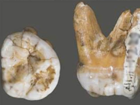 Bilim ve Teknik Dergisi"nin OH 65 Fosili ve Dişlerin Kökeni Hakkındaki Yanılgıları