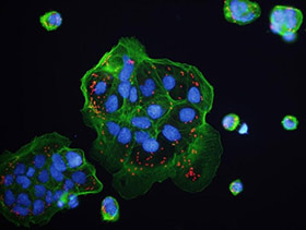 Bir Yaratılış Harikası: Ölmeye Programlı Hücreler
