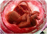 Embriyo İçin En Güvenli Yer: Anne Rahmi